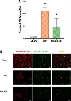 Cardioprotective Roles of β-Hydroxybutyrate Against Doxorubicin Induced Cardiotoxicity